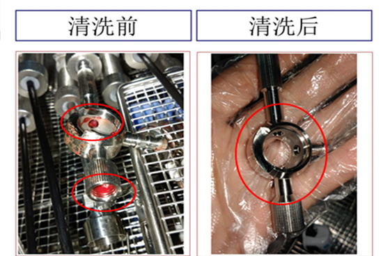 醫(yī)用器械精密清洗丨超聲波清洗機(jī)進(jìn)行了哪些創(chuàng)新